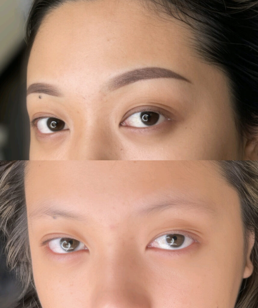eyebrow before and after 7