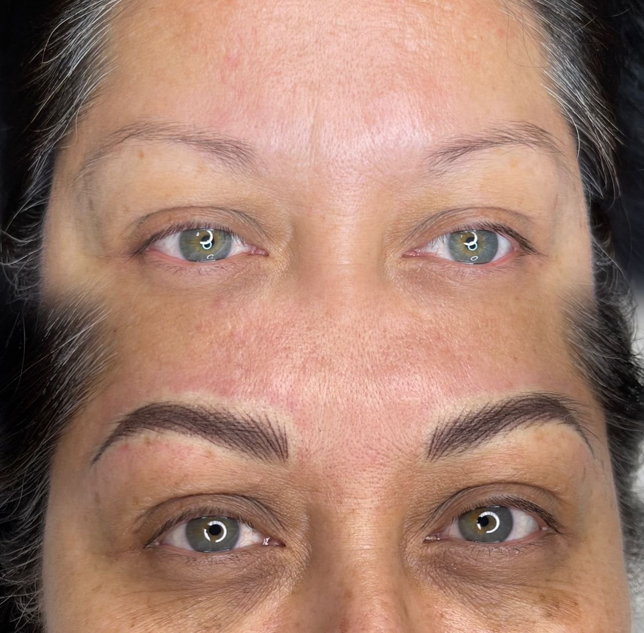 before & after